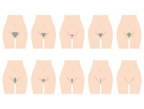 Vラインの色んな形